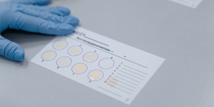 Mastering Inter-Laboratory Flow Cytometry Instrument Standardization for Reliable Results
